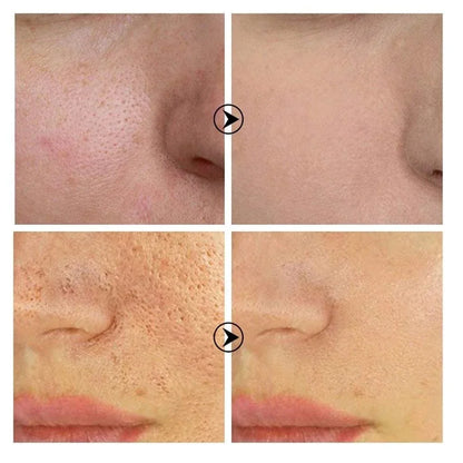 Sérum Facial con Retinol y Niacinamida para Poros